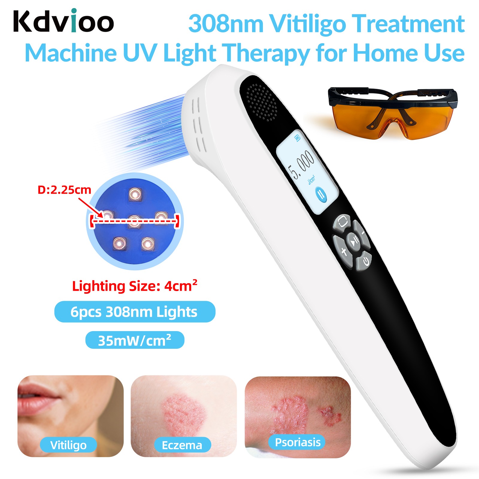 Handheld 308nm Excimer Lamp For Skin Diseases Treatment Portable Blue Light