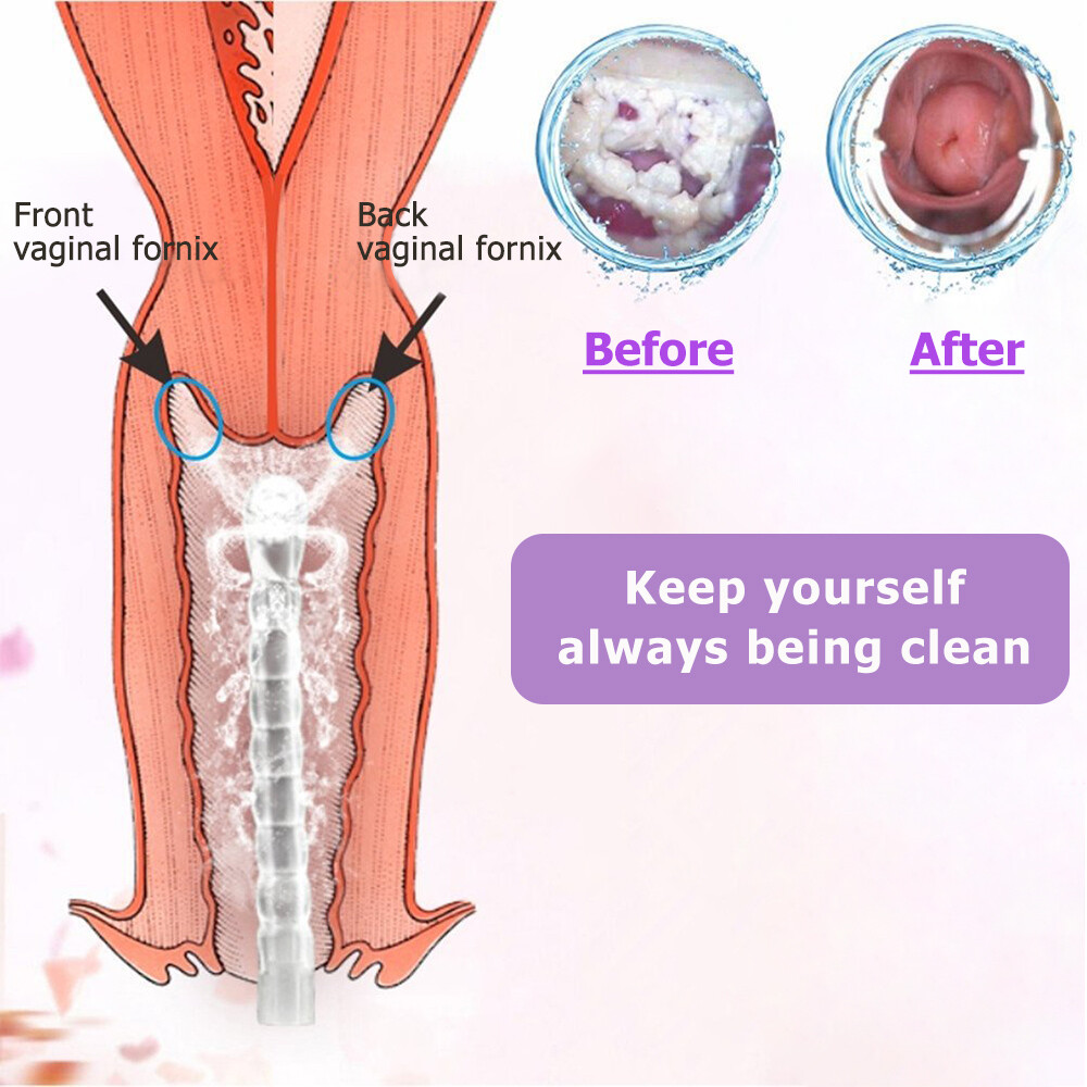 Women Enema Anal Vaginal irrigator Enemator Douche Cleaner Bottle Pump 300ML