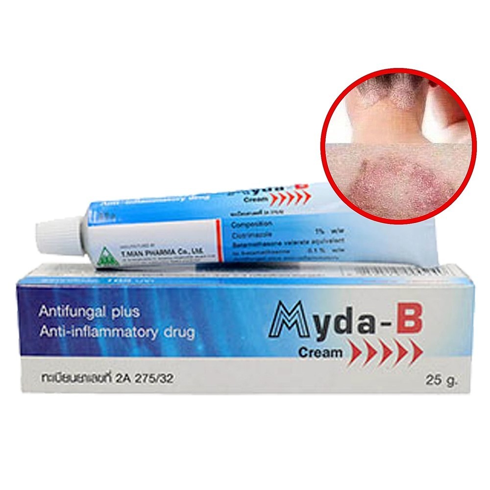 Myda‑B 25g Cream Anti‑Inflammatory & Antifungal Treatment Athlete’s Foot Fungal