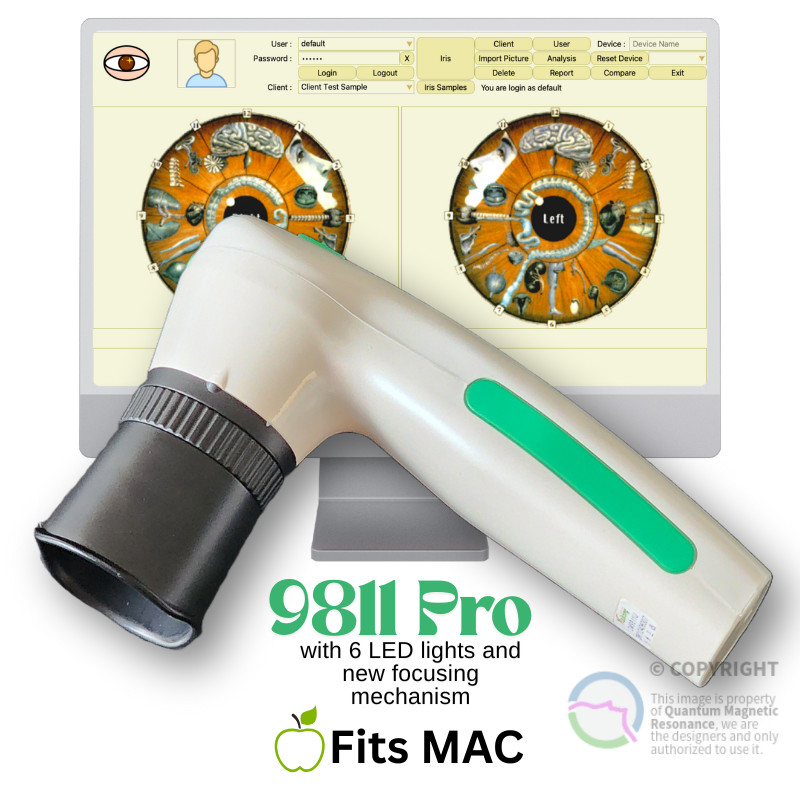 2025 Iridology Camera Fit MAC 12 MP HD 30X Iriscope 9811 Pro Iris CCD Analysis