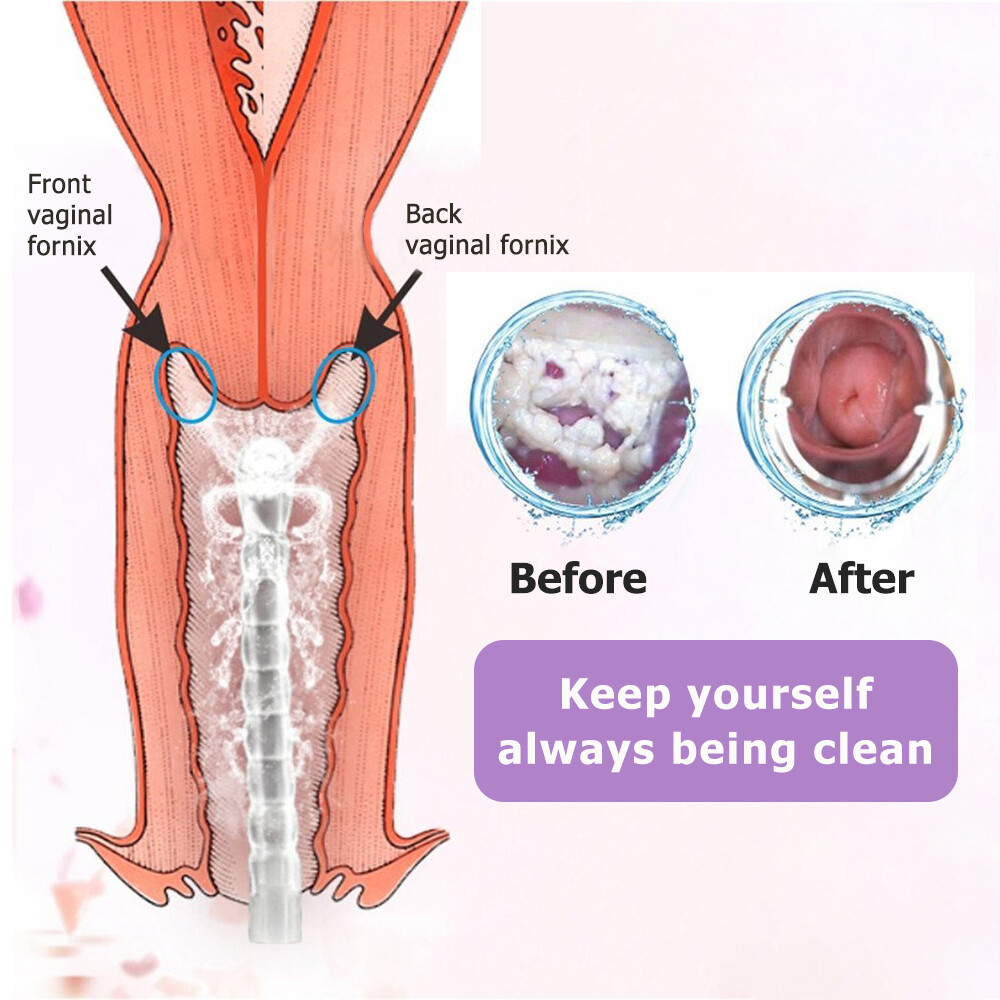 300 ml Reusable Vaginal Cleansing System Female Vaginal Rinse, Manual Cleanser