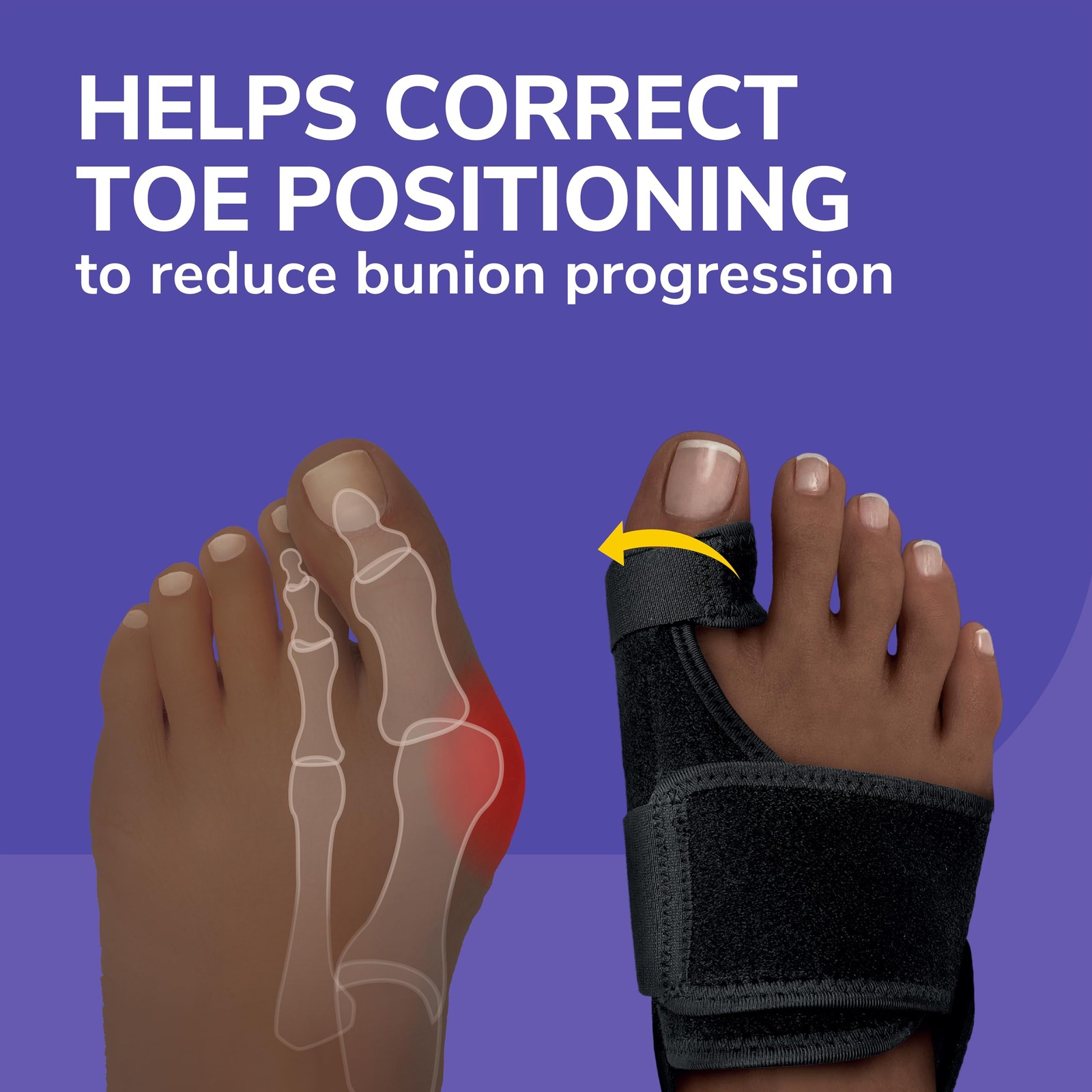Bunion Corrector Gel Splint Big Toe Straightener Pain Relief Dr Scholls Women