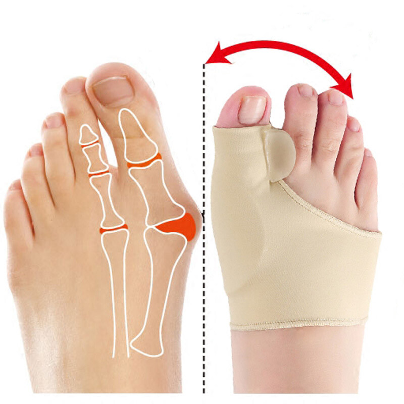 Big Toe Bunion Corrector Splint Straightener Valgus Pain Relief Big Bone Orthop