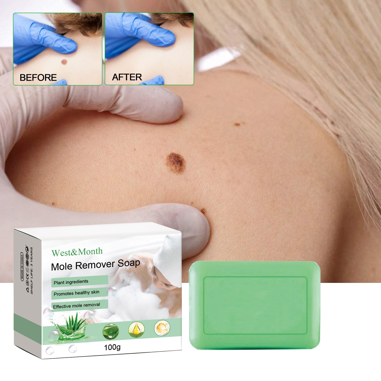 Mole Remover Soap, Repair Meat Granules Corns And Dark Moles, Smooth Skin Anti-w