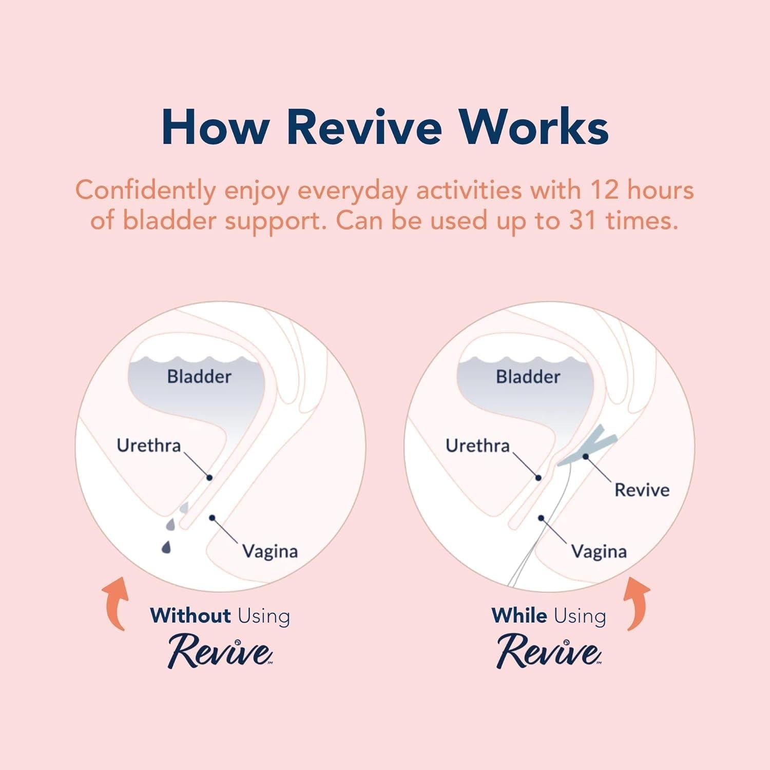 Revive Vaginal Device – Incontinence Support for Women