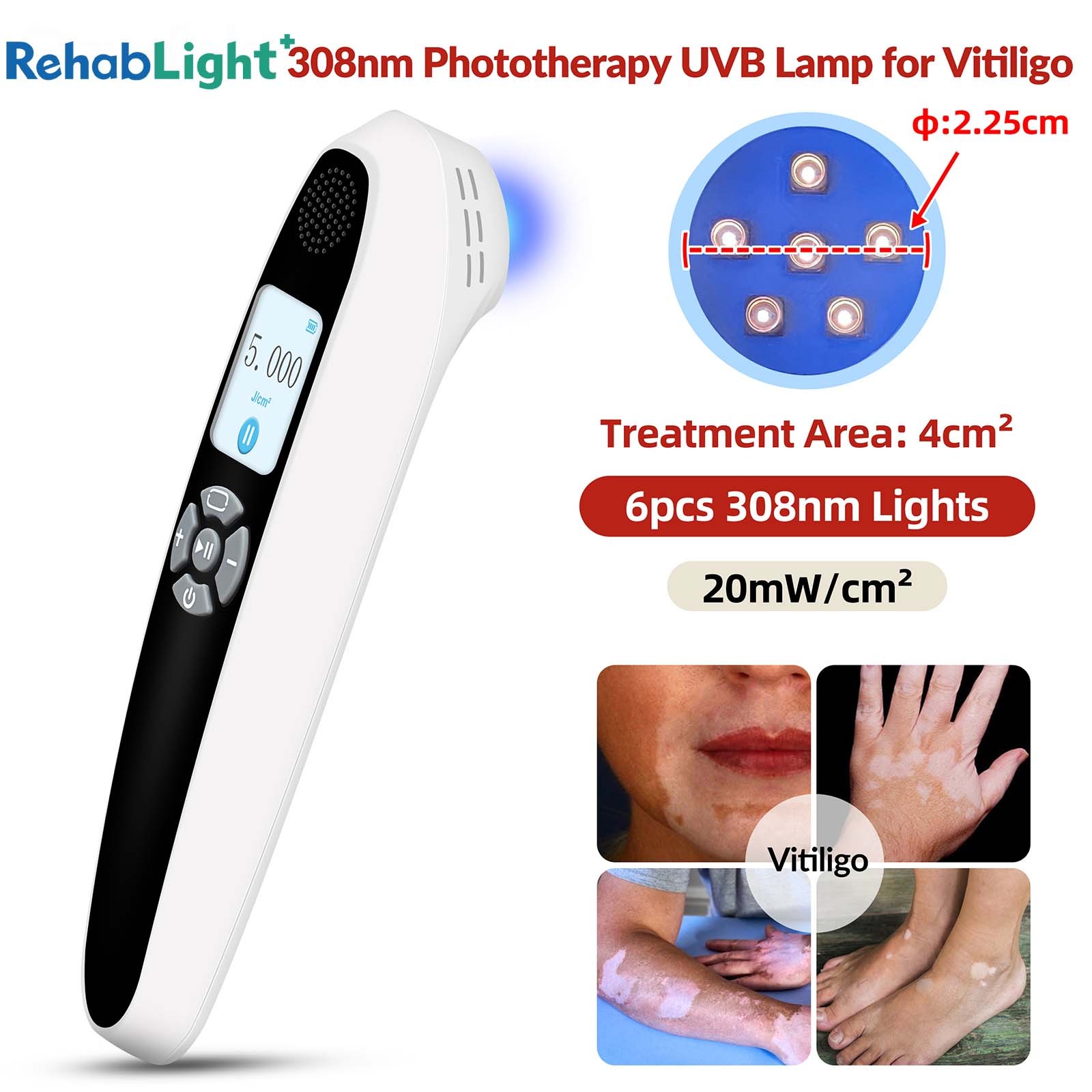 308nm Excimer Lamp UVB Light Unit LCD Screen 110-240V Portable Handheld Skin Dot