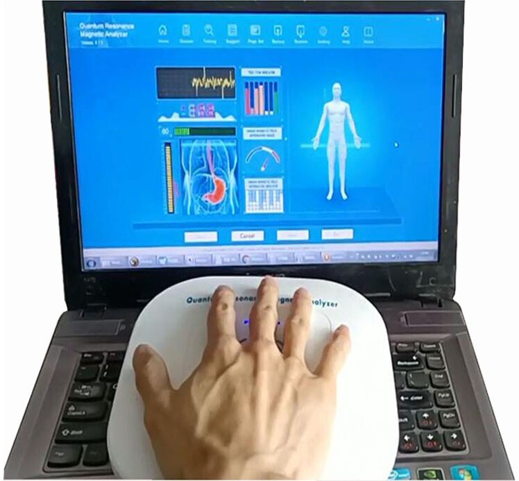 Family clinics and beauty salons use quantum bioelectric human body analyzers