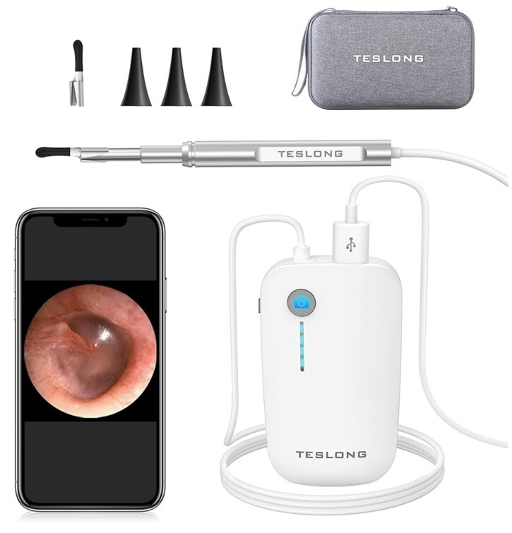Digital Otoscope Ear HD Camera Ear Wax Removal Tools Video Ear Scope Phone Comp