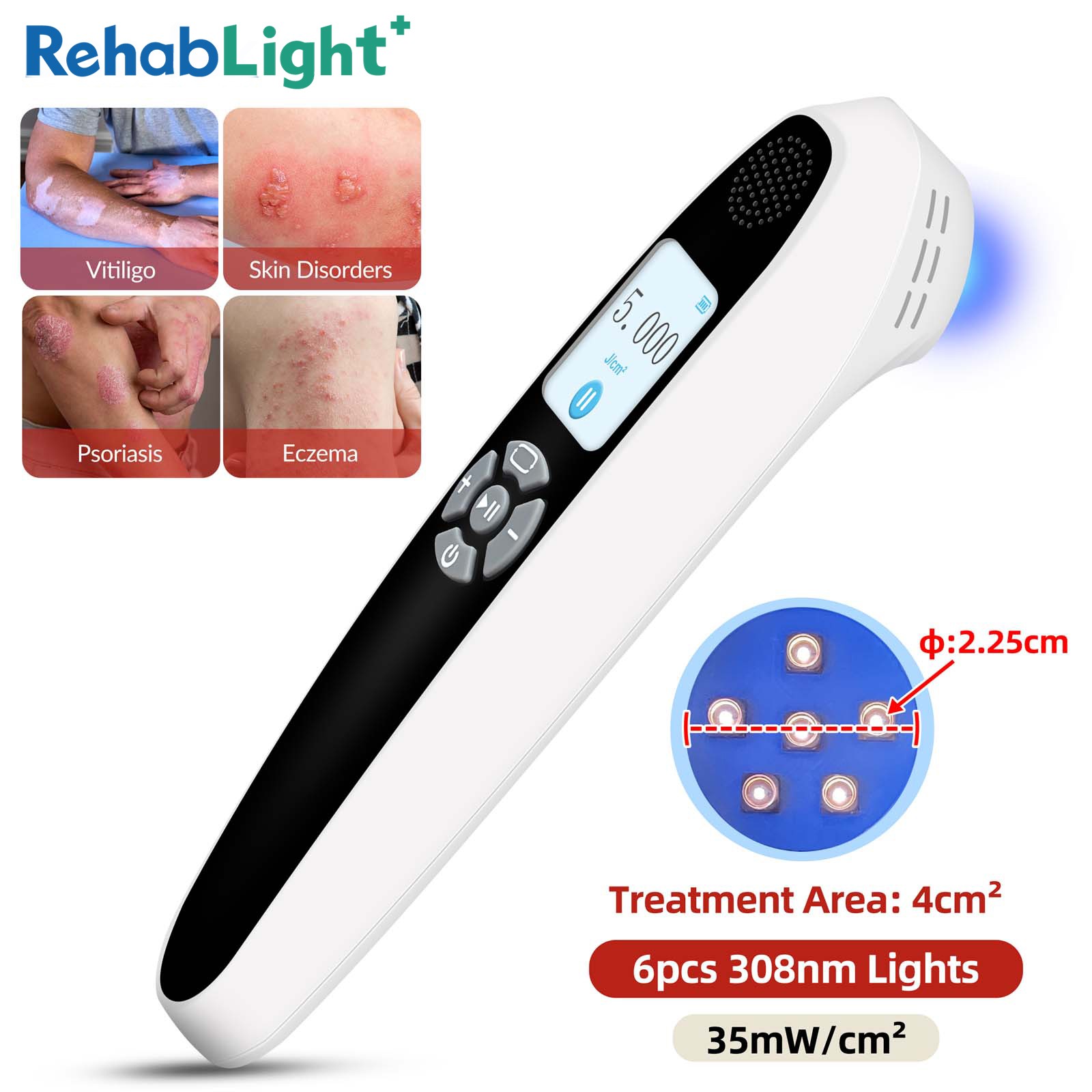 Rechargeable 308nm UVB Lamp Handheld 6 Diodes Narrowband for Skin Support Home