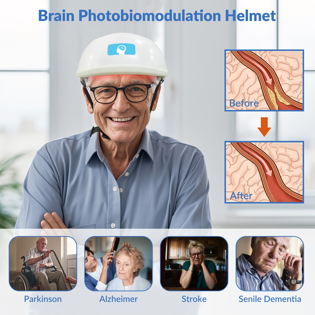 810nm NIR Photobiomodulation Brain Helmet for Depression Anxiety Insomnia Stroke