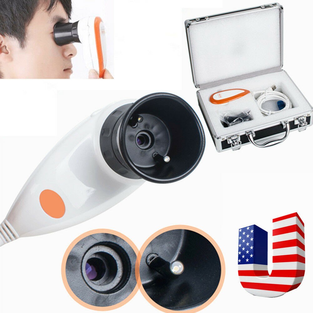 Professional Iris Scanning Analyzer Iris Camera Iris Mirror for The Eyes 5.0MP