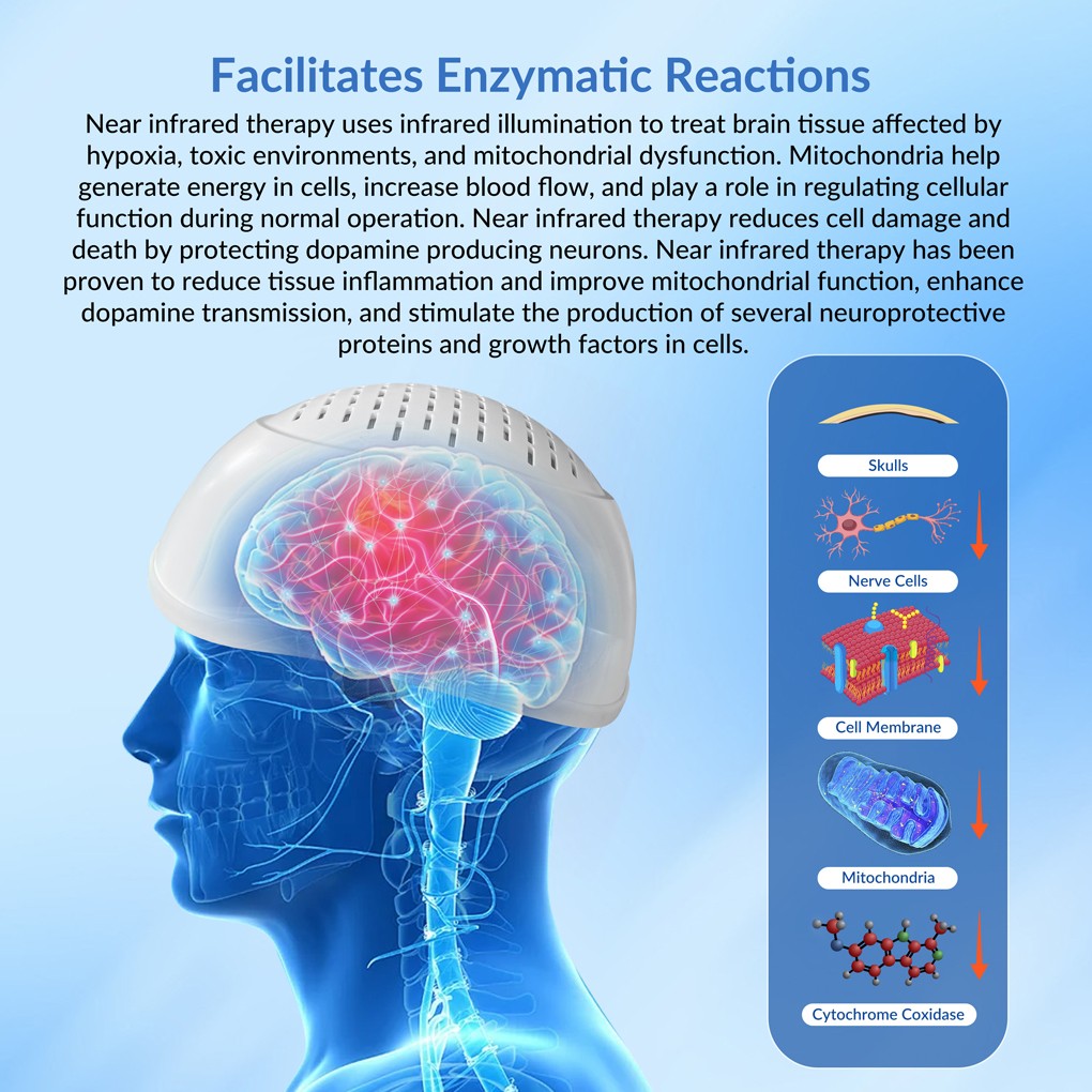 810nm NIR Photobiomodulation Brain Helmet for Depression Anxiety Insomnia Stroke