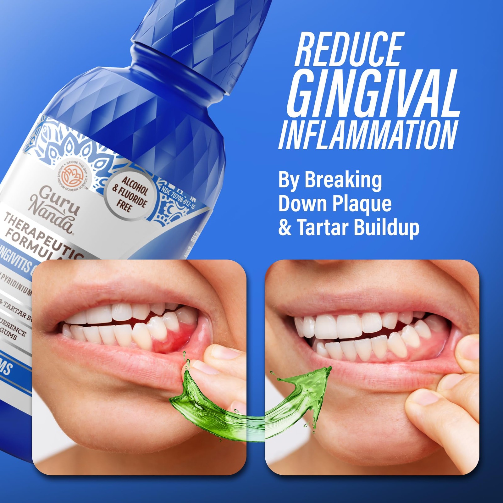 Mouthwash Healthy Gums Antigingivitis Oral Rinse Wild Mint 16 Fl Oz GuruNanda