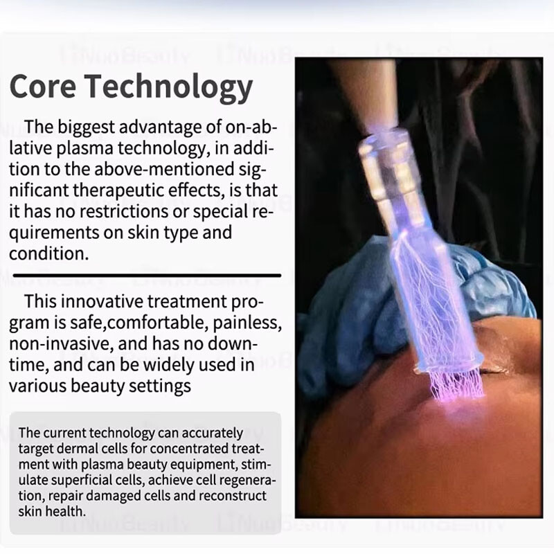 Cold Plasma Skin Therapy Machine Wrinkle Removal Spot Lightening Anti-Aging