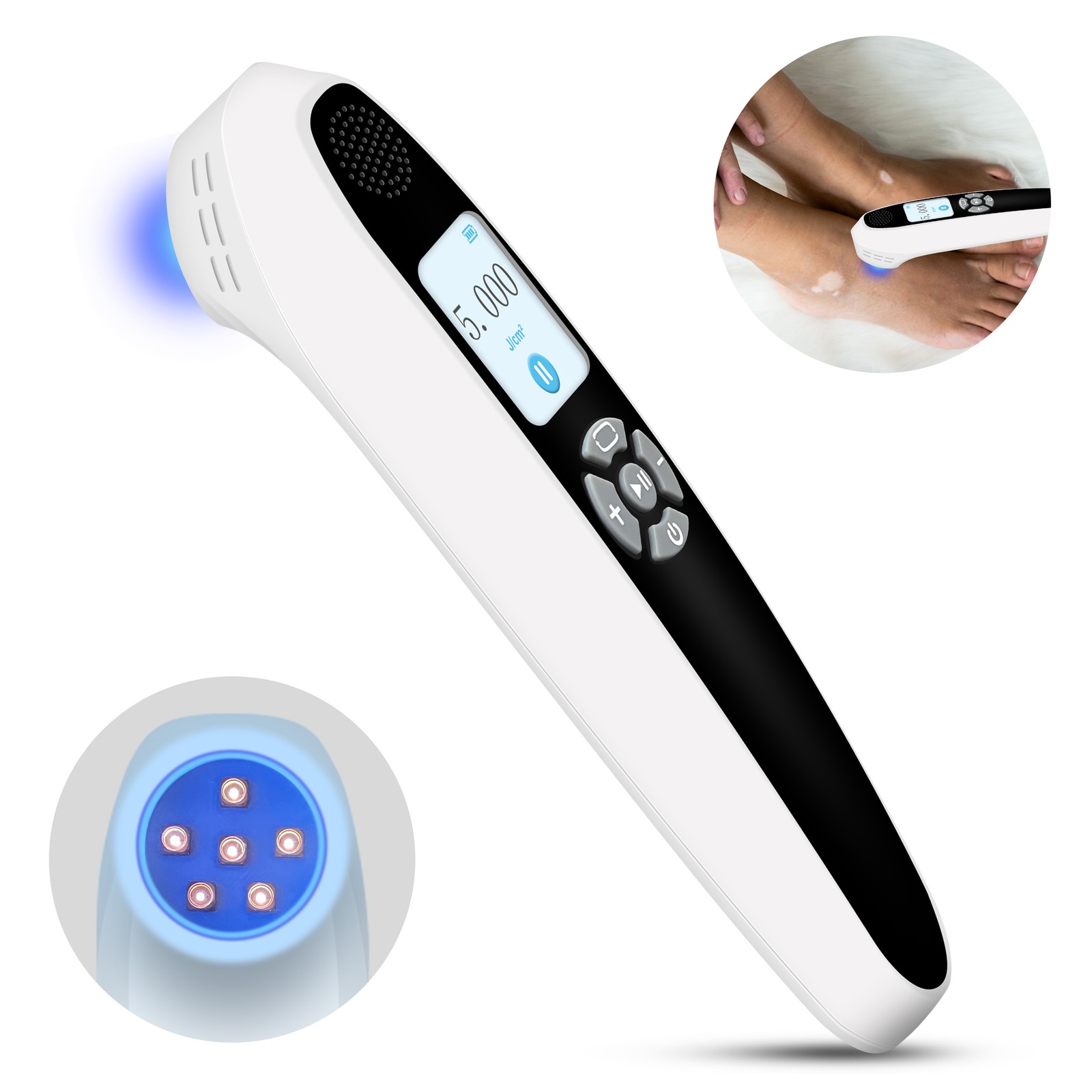308nm Excimer UVB Phototherapy Lamp 6 Diodes 35mW Handheld for Skin Repair Home