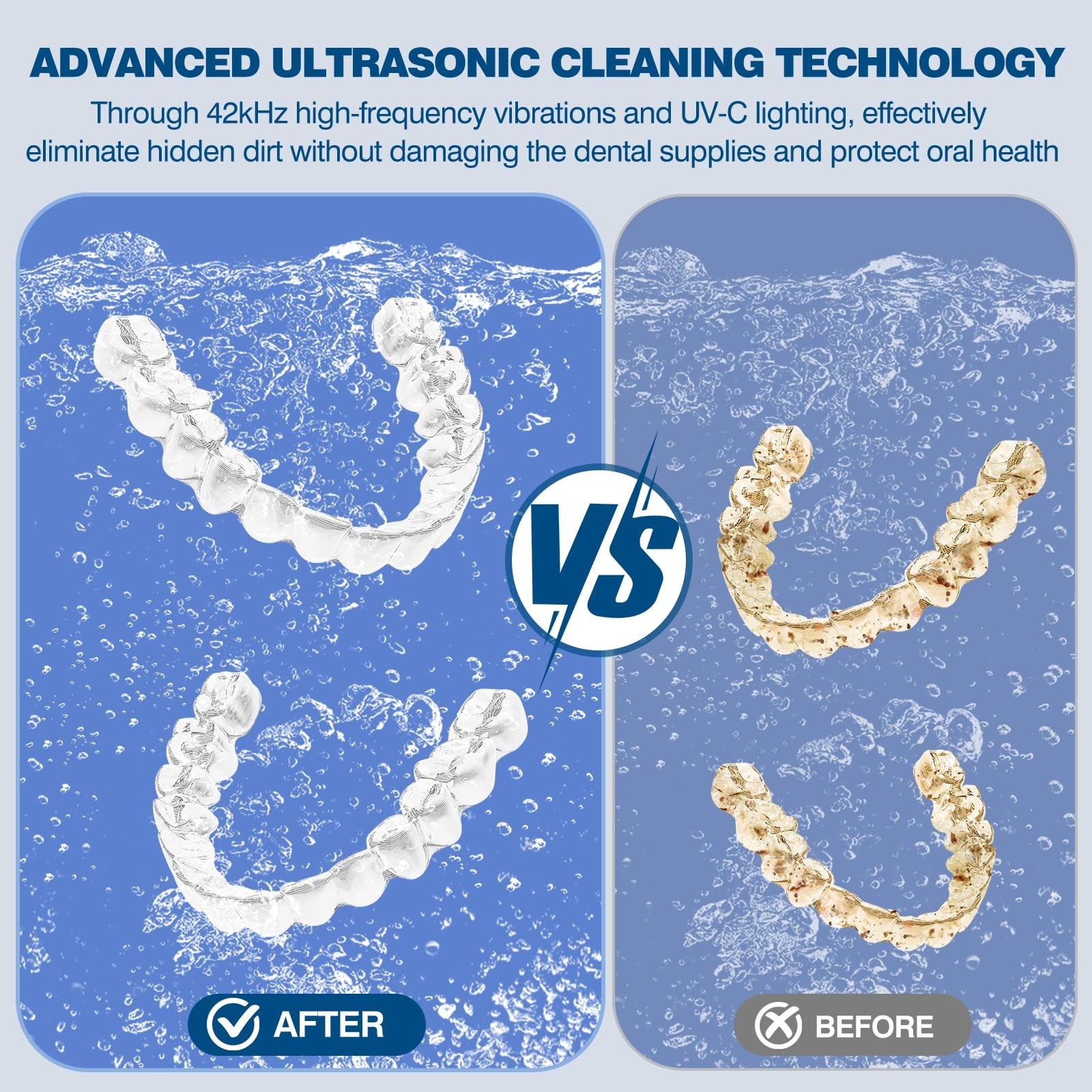 Ultrasonic Retainer Cleaner Machine – Professional 42KHz Dental Black