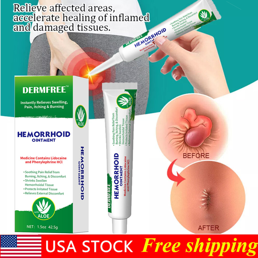 Hemorrhoid & Fissure Ointment Hemorrhoids Treatment Internal Piles Pain Relief
